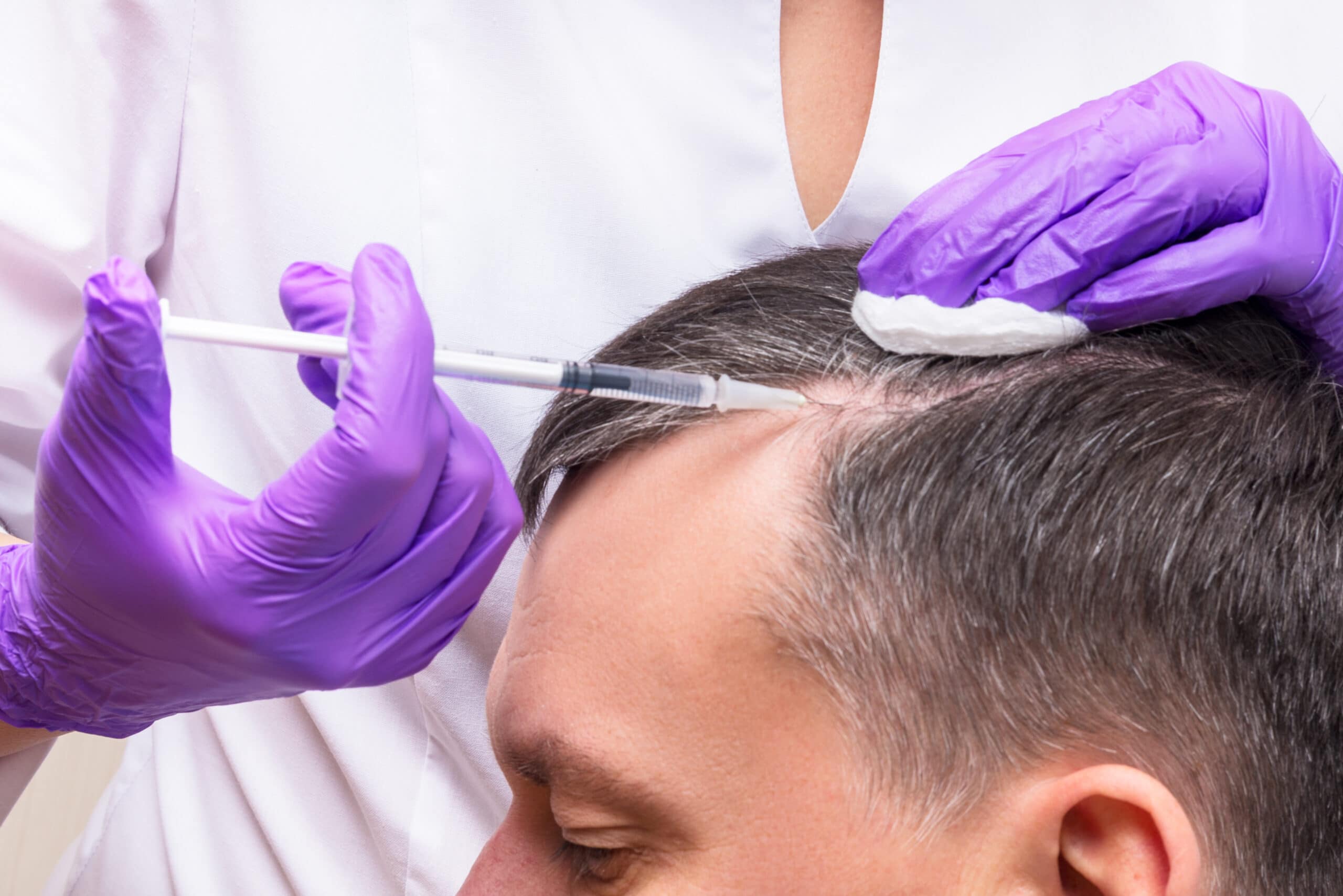 Hair Restoration